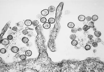 Australijskie laboratorium utraciło niebezpieczne wirusy z ...
