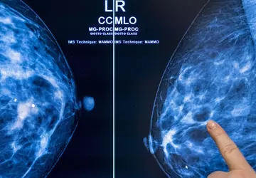 Badania przesiewowe w kierunku raka z ...