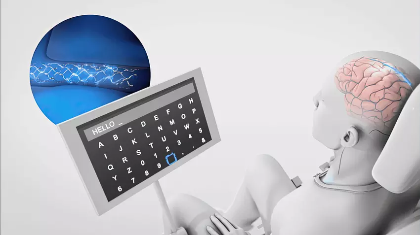 Synchron zintegrował ChatGPT ze swoimi implantami mózgowymi