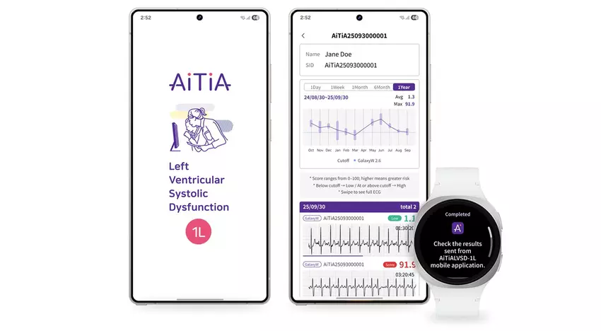 Samsung zaktualizował Galaxy Watch: inteligentny zegarek teraz wykrywa oznaki niewydolności serca za pomocą EKG i AI
