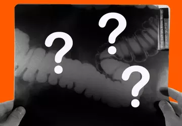 Lekarze, którzy korzystali z urządzeń z ...