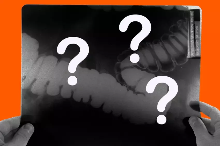 Lekarze, którzy korzystali z urządzeń z AI, tracą kwalifikacje