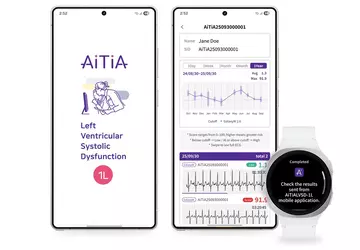 Samsung zaktualizował Galaxy Watch: inteligentny zegarek ...