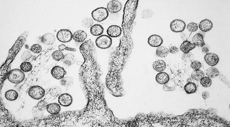 Australijskie laboratorium utraciło niebezpieczne wirusy z powodu awarii zamrażarki