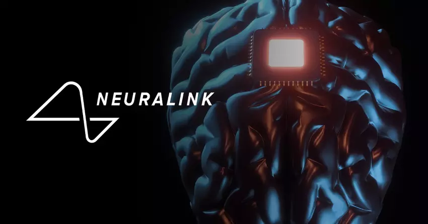 Osoba niewerbalna otwarta na komunikację: Neuralink przeprowadził trzecią udaną operację wszczepienia chipu w mózg pacjenta