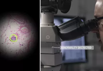 Inteligentny mikroskop Google pomaga diagnozować raka