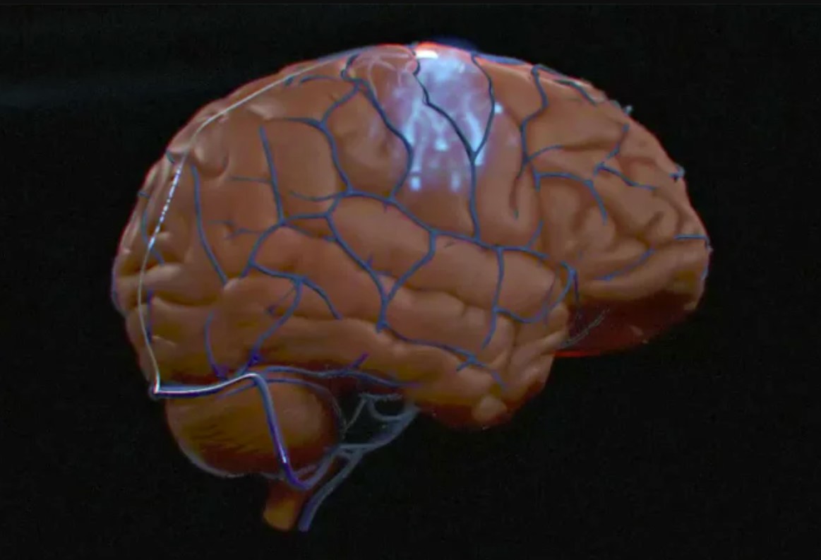 Synchron to pierwszy w Stanach Zjednoczonych, który wszczepił interfejs ludzki mózg-komputer