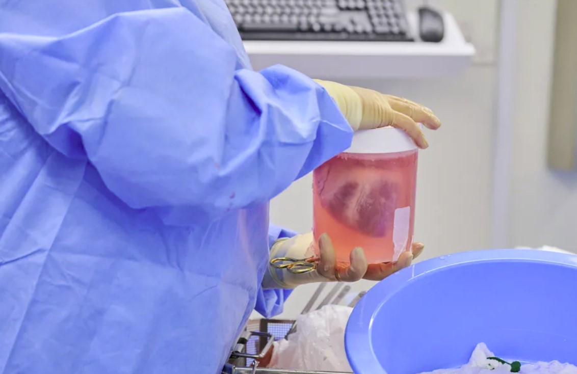 Naukowcy przeszczepili genetycznie zmodyfikowane świńskie serca do ciał zmarłych